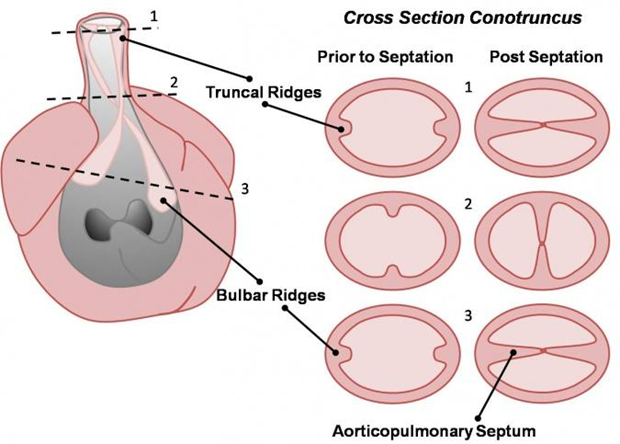 Hình minh họa sự hình thành vách nón–thân (aorticopulmonary septum) trong phát triển phôi tim.