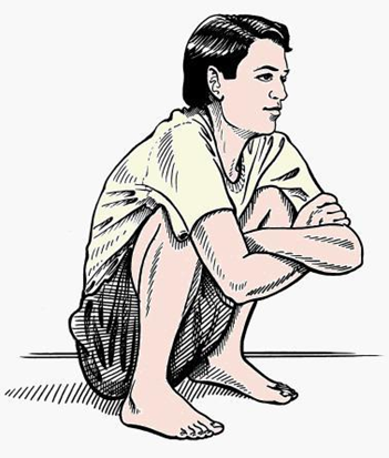 Hình minh họa dấu Squatting (ngồi xỏm) dương tính ở trẻ bị tim bẩm sinh