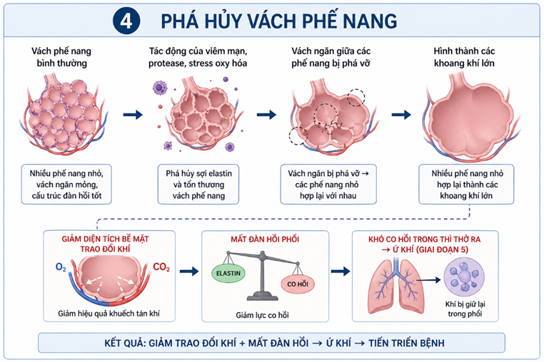 Hình ảnh minh họa giai đoạn phá hủy vách phế nang trong Khí phế thủng 