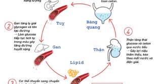 DKA trong DTD 1