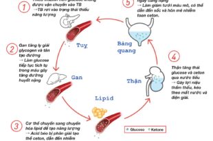 DKA trong DTD 1