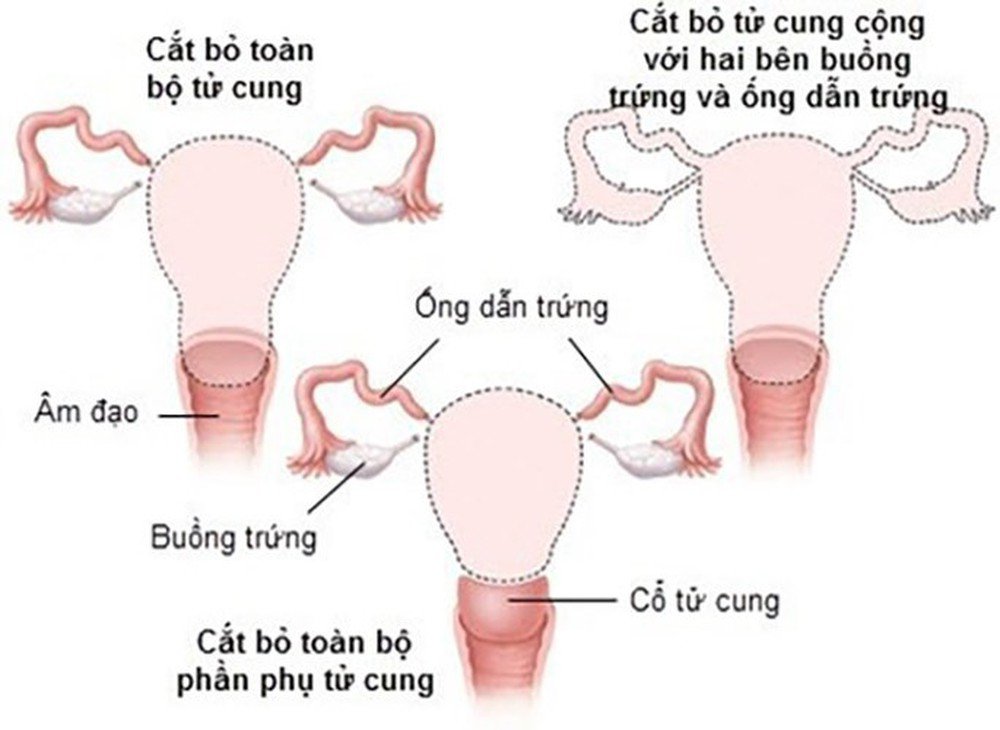 cat bo tu cung 16584592751591242819273