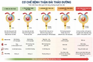 5 giai doan trong benh than dai thao duong