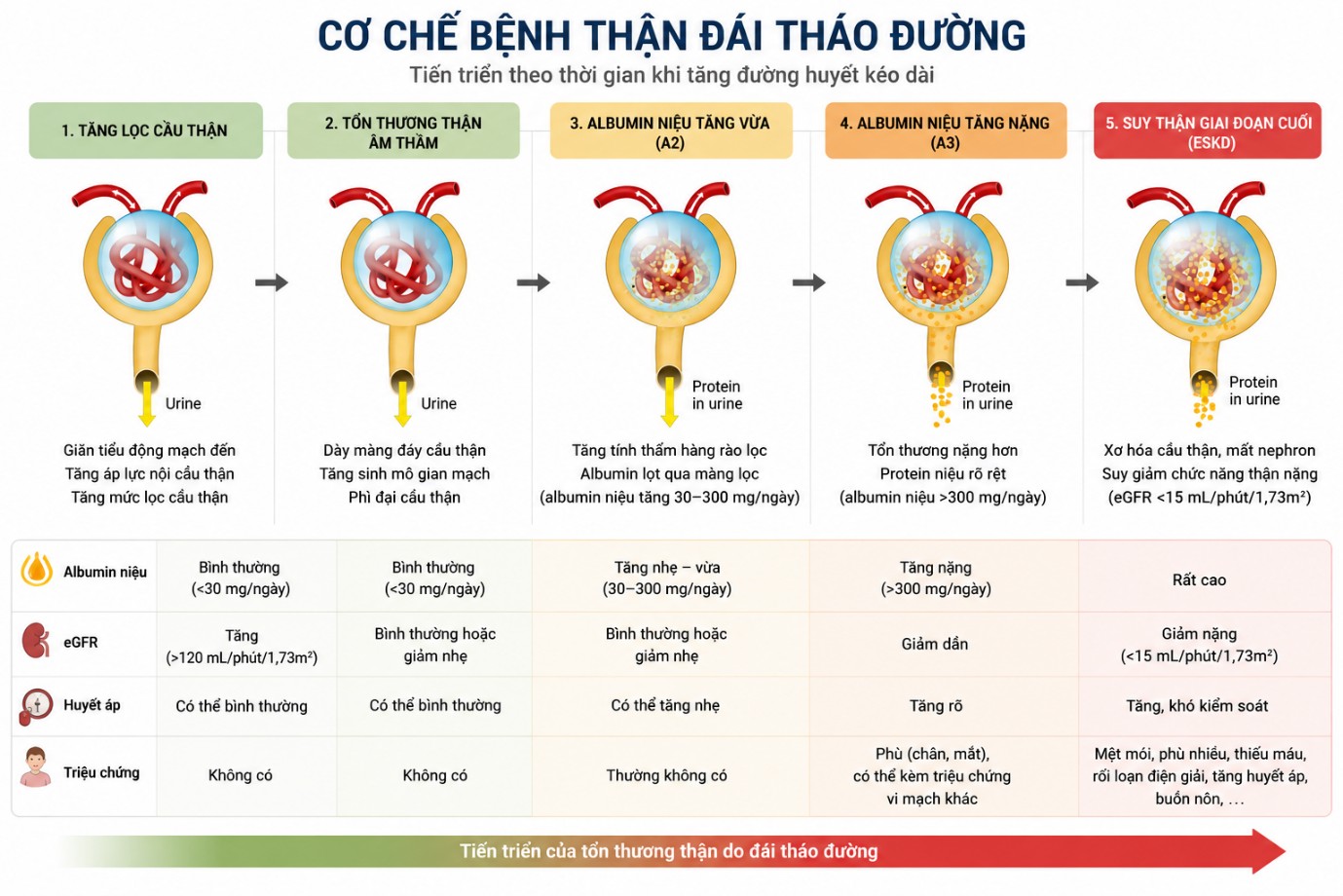 Bệnh thận đái tháo đường: Cơ chế tổn thương, yếu tố nguy cơ và tiến triển bệnh Hình ảnh mô tả tổng quan 5 giai đoạn trong cơ chế bệnh thận đái tháo đường theo mô hình Mogensen