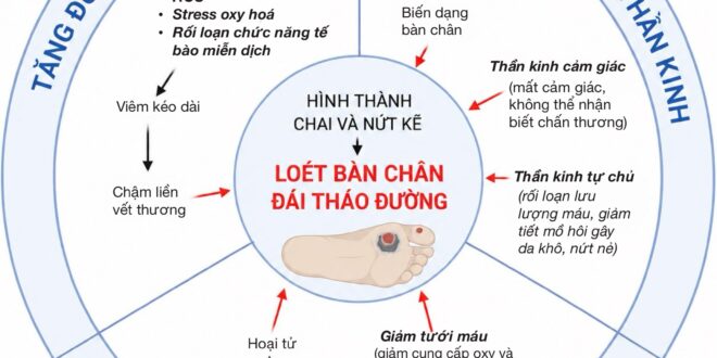 Hình ảnh minh họa tổng quan 3 yếu tố chính hình thành DFU và chi tiết hoạt động từng yếu tố