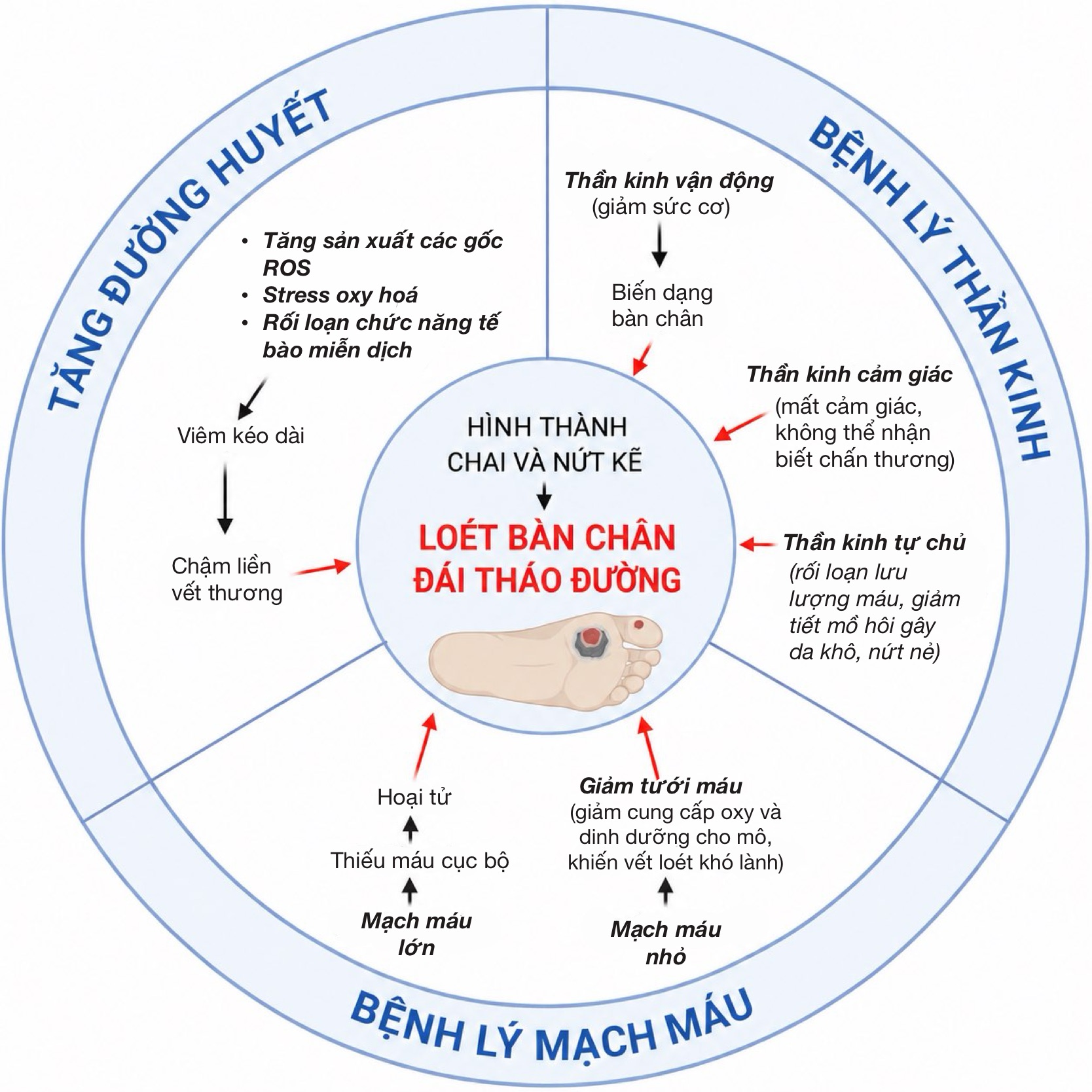 Cơ chế bệnh sinh của loét bàn chân đái tháo đường (DFU) Hình ảnh minh họa tổng quan 3 yếu tố chính hình thành DFU và chi tiết hoạt động từng yếu tố