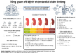 Tong quan ve benh than do dai thao duong 2